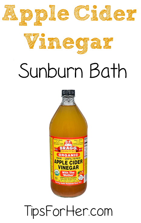 ACV Sunburn Bath