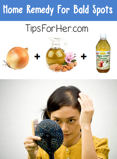 Home Remedy for Bald Spots