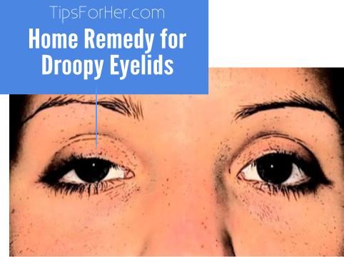 How to Fix Your Droopy Eyelids without Surgery